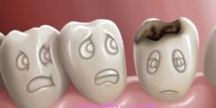 اسنان مسوسة تسبب لك الألم تعرف على أسبابها وطرق العلاج