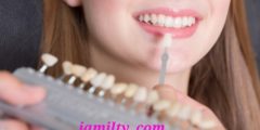 انواع تلبيسات الاسنان الصمغية والخزفية وسعر التركيبات
