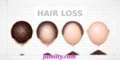 علاج تساقط الشعر للرجال باستخدام الادوية والثوم وطرق الوقاية
